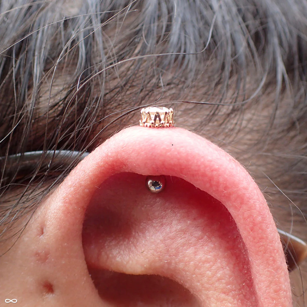 King Press-fit End in Gold from Anatometal - Image 22